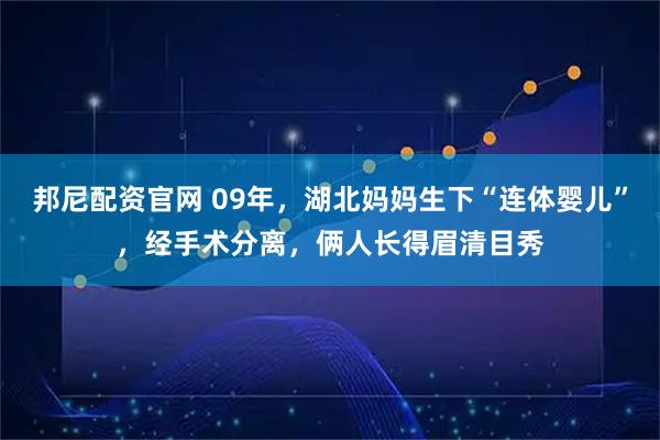 邦尼配资官网 09年，湖北妈妈生下“连体婴儿”，经手术分离，俩人长得眉清目秀